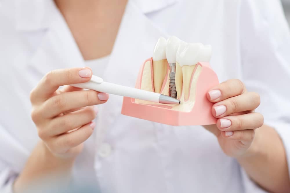 Implantologie Kutscher (11 (1)