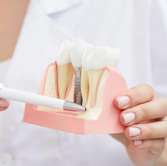 Implantologie Implantat Planung